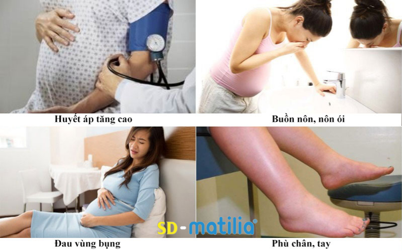 Thừa cân khi mang thai dễ khiến mẹ bị tiểu đường thai kỳ nặng hơn là tiền sản giật rất nguy hiểm