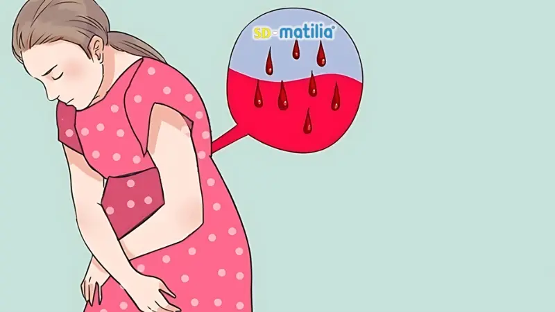 Chảy máu âm đạo sau sinh