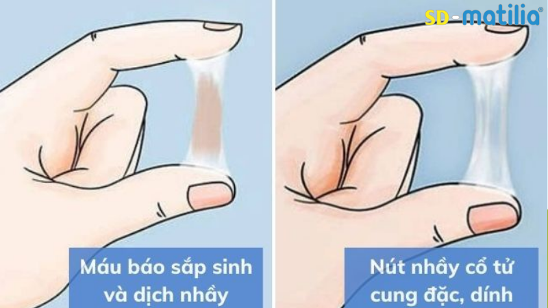 Nút nhầy bảo vệ cổ tử cung bị xuất ra ngoài là dấu hiệu chuyển dạ sắp sinh rõ nét nhất